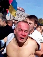 Шуфричу в Одессе натолкали бока (фото, видео)