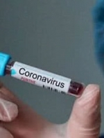 Минздрав закупил тесты на коронавирус для более 90 000 человек