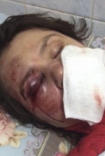 Генпрокуратура до сих пор не нашла виновных в избиении журналистов