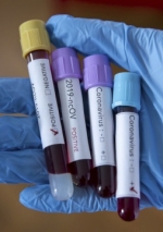 Минздрав зафиксировал четыре случая передачи Covid-19 внутри страны