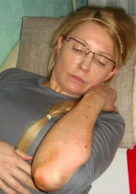 Евгения Тимошенко: Мама не просила измерить радиацию в палате, это все ложь