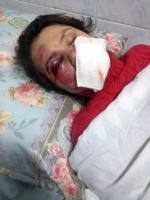 Задержан пятый подозреваемый в деле об избиении Татьяны Черновол