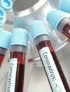 В Украине более 20 тысяч случаев Covid за сутки, больше всего на Франковщине и Львовщине