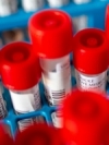 В воскресенье в Украине зафиксировали 5 804 больных Covid и 297 смертей